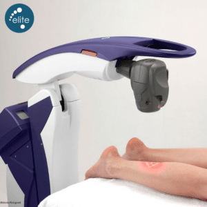 treating neuropathy with MLS laser