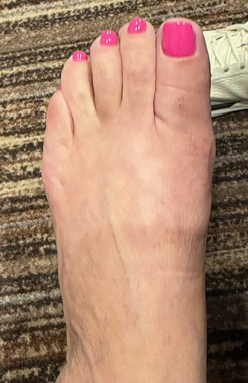 After Image: Conditions Treated - front