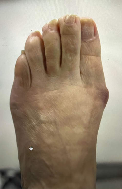 Before Image: Conditions Treated - front