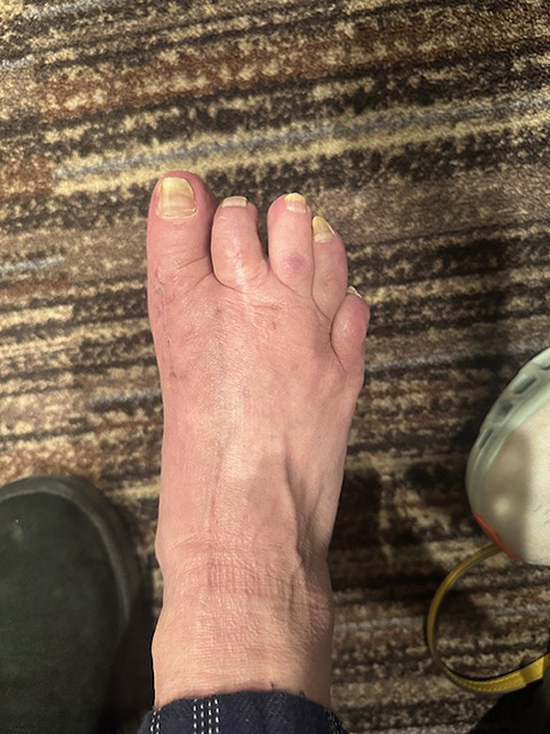 After Image: Conditions Treated - front