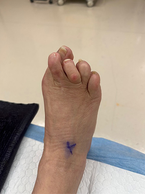 Before Image: Conditions Treated - front